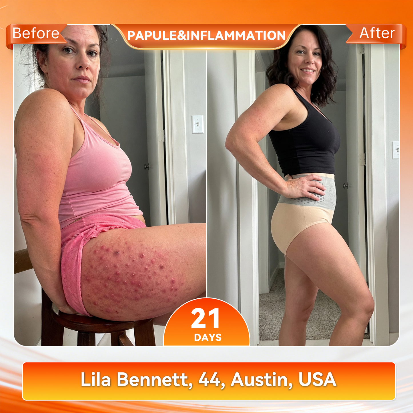 🥇𝐏𝐀𝐔𝐑𝐀𝐉𝐔® 𝟐𝟎𝟐𝟔 𝐌𝐨𝐫𝐢𝐧𝐠𝐚 & 𝐁𝐞𝐫𝐛𝐞𝐫𝐢𝐧𝐞 𝟒-𝐈𝐧-𝟏 𝐌𝐢𝐜𝐫𝐨-𝐏𝐚𝐫𝐭𝐢𝐜𝐥𝐞 𝐒𝐜𝐮𝐥𝐩𝐭𝐢𝐧𝐠 & 𝐅𝐚𝐭-𝐁𝐮𝐫𝐧 𝐒𝐡𝐨𝐫𝐭𝐬
