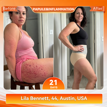 🥇𝐏𝐀𝐔𝐑𝐀𝐉𝐔® 𝟐𝟎𝟐𝟔 𝐌𝐨𝐫𝐢𝐧𝐠𝐚 & 𝐁𝐞𝐫𝐛𝐞𝐫𝐢𝐧𝐞 𝟒-𝐈𝐧-𝟏 𝐌𝐢𝐜𝐫𝐨-𝐏𝐚𝐫𝐭𝐢𝐜𝐥𝐞 𝐒𝐜𝐮𝐥𝐩𝐭𝐢𝐧𝐠 & 𝐅𝐚𝐭-𝐁𝐮𝐫𝐧 𝐒𝐡𝐨𝐫𝐭𝐬