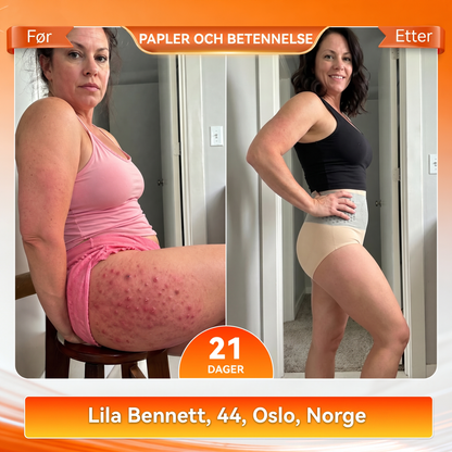 𝐏𝐀𝐔𝐑𝐀𝐉𝐔® 2026 Moringa & Berberin 4-i-1 Formende Fettforbrenningsshorts med Mikropartikler 🌻